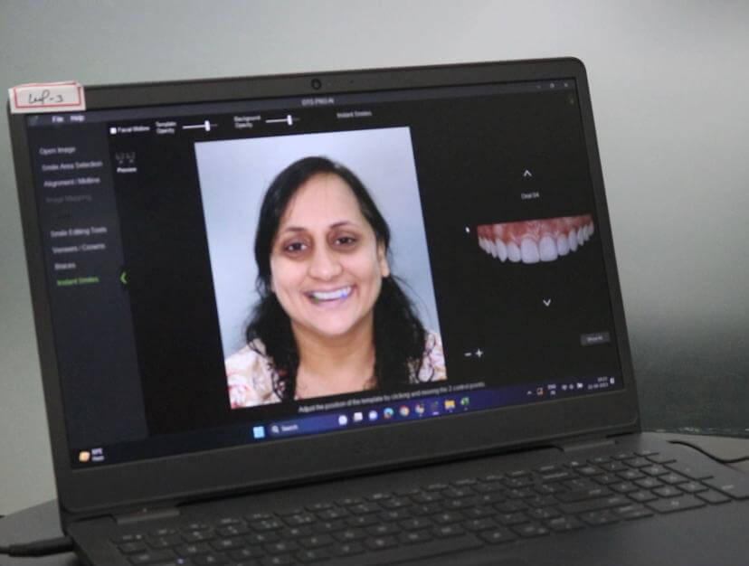 Digital Smile Design